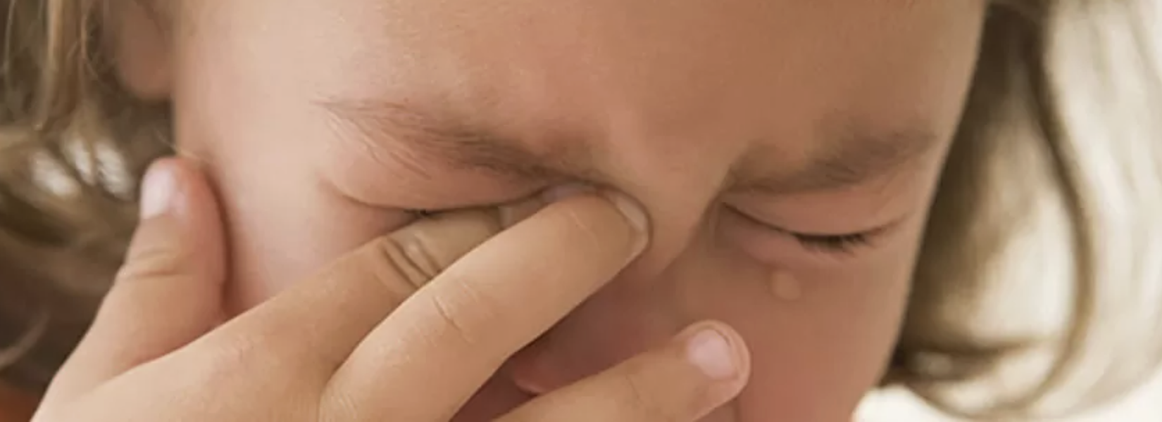 Alerjik Konjonktivit Nedir?